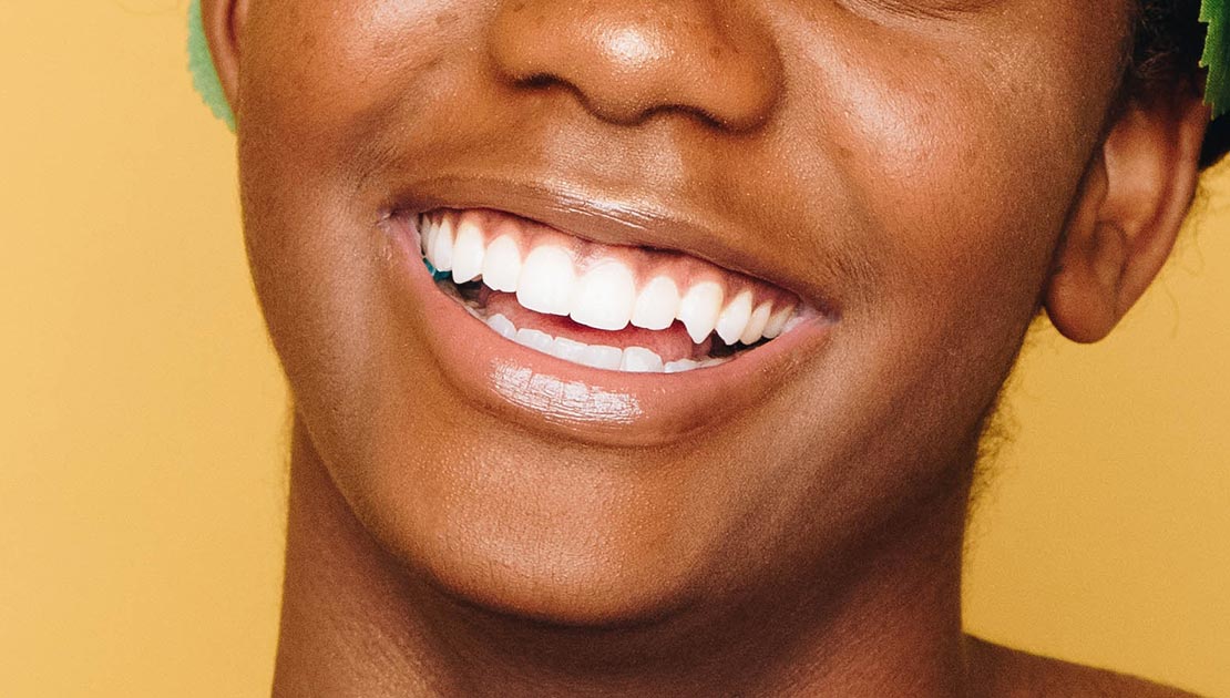 Person smiling with dental veneers in front of a yellow background