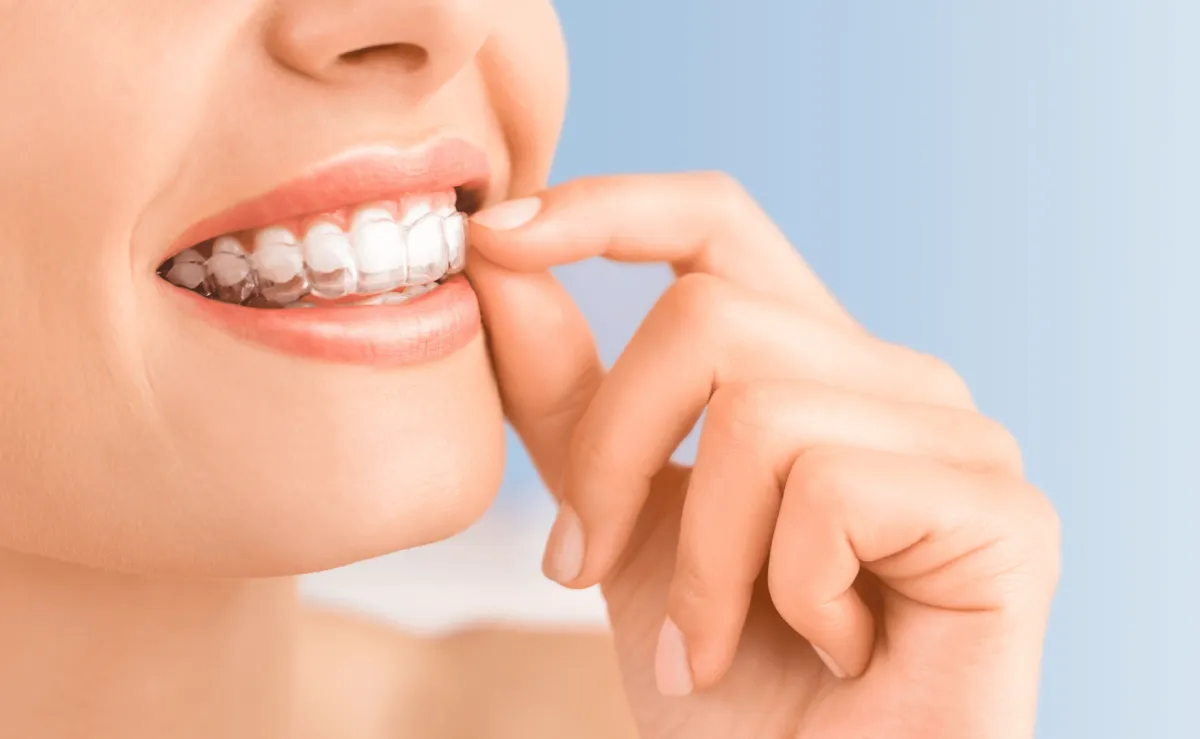 Woman applying Clear Dental Aligners