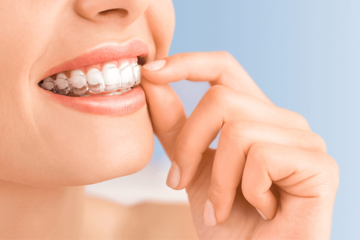 Woman smiling and holding clear dental aligners to her teeth