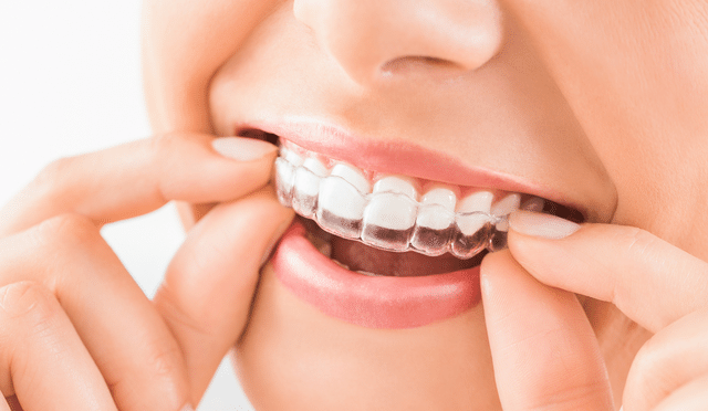 Woman smiling and holding clear dental aligners to her teeth