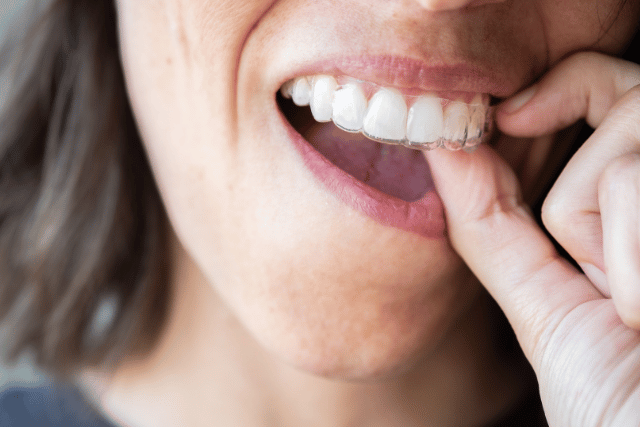 woman with white healthy teeth